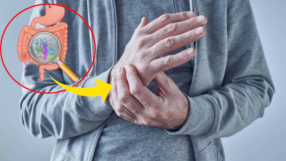 Il dolore alle articolazioni potrebbe essere collegato ai batteri nell’intestino