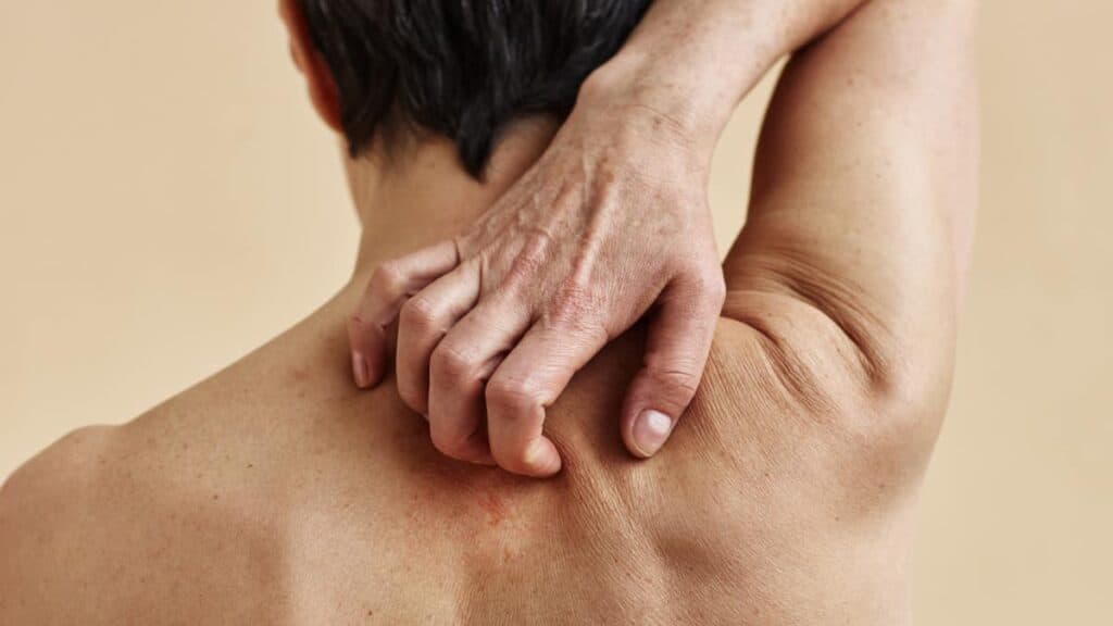 Ecco i motivi che causano il prurito alla schiena e come risolverlo.